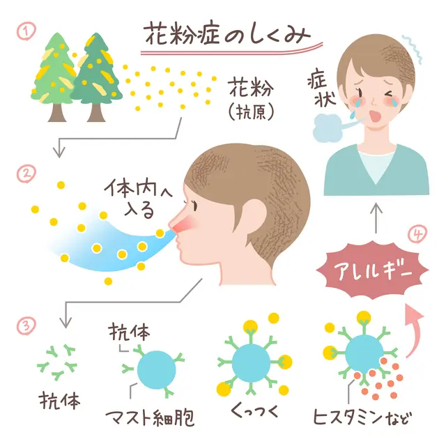 花粉症の仕組み