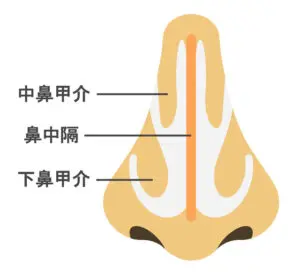 鼻中隔